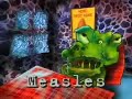 Measles