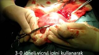 Ebru Ünal-16