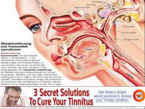 vitamin d deficiency symptoms tinnitus