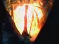  - MovieZen Video