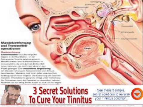 how to unclog ringing ears