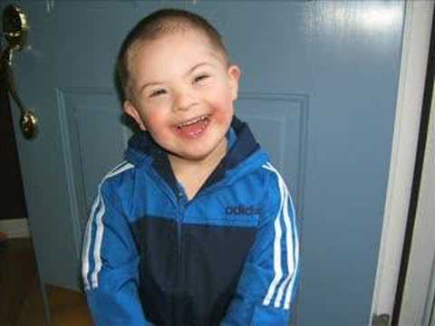 Down Syndrome Slide Show
