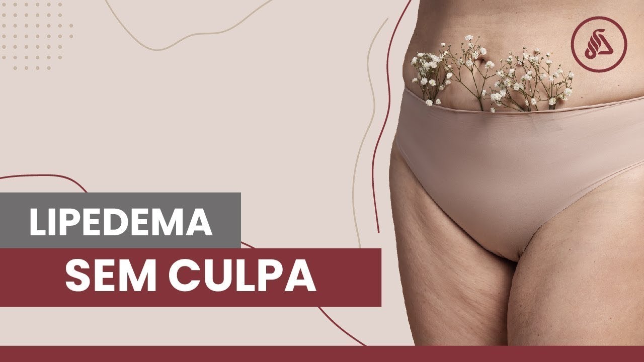 Como tudo encontrou seu caminho no Lipedema? [depoimento]