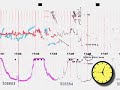 Fetal Heart Monitor Animation