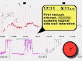 Fetal Heart Monitor Animation