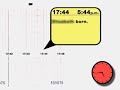 Fetal Heart Monitor Animation
