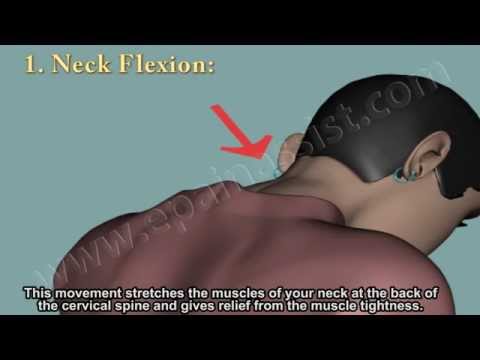 how to treat wry neck