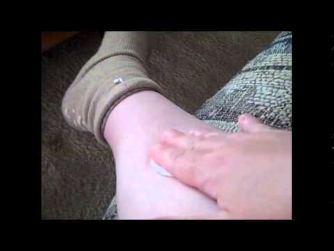 how to reduce varicose veins