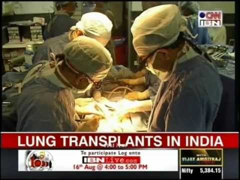 how to get a lung transplant