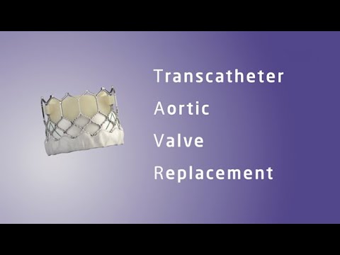 What is transcatheter aortic valve replacement (TAVR)?