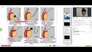 Клинический опыт лечения методом TESE/ICSI пациентов с азооспермией