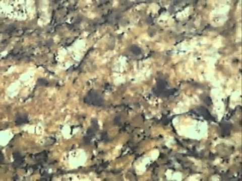 [Video title]