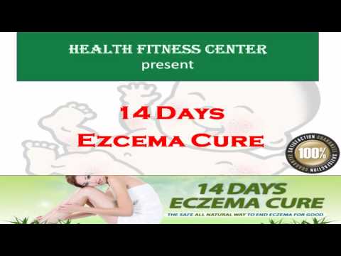 how to permanently cure eczema