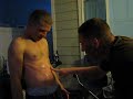 mills chest hair removal