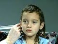 Abnormal Cranial Nerve VIII - Auditory Acuity, Weber & Rinne