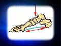 Plantarfaciilitis www.footknepain.com.au