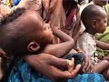 UNICEF: Ethiopia's nutrition crisis Infant and Toddler Nutrition