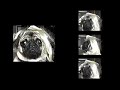 The Puggy Bunch
