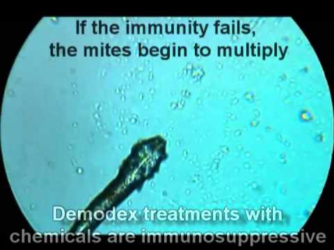 how to get rid demodex