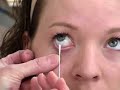 Throat, eye and nasopharyngeal swabs for culturing