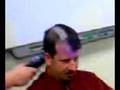 Shaving