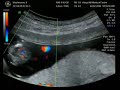 14 week scan - boy 14 week scan - boy