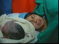 Epidural Doğum - Dr. Kağan Kocatepe