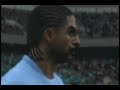 Fifa 11 - Bugs and Glitches