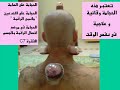 naser1969 / CUPPING THERAPY / UAE/ ALAIN