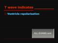 videos de Free FPGEE Test Material Preparation :: One Liners  -  ECG Waves