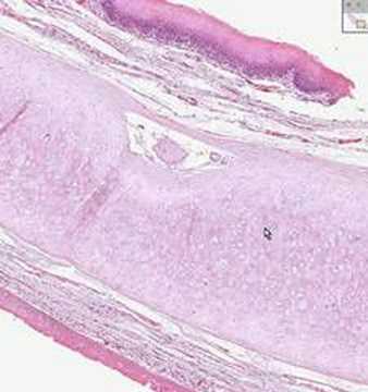 Shotgun Histology Epiglottis