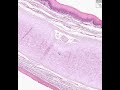 Shotgun Histology Epiglottis