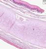 Shotgun Histology Epiglottis