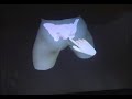 (1999) This virtual reality simulation of the pelvic floor is shown running on an ImmersaDesk at the Virtual Reality Medicine Laboratory (VRMedLab) at the University of Illinois, Chicago. Both the Pelvic Floor simulation and the ImmersaDesk were developed at the Electronic Visualization Laboratory (EVL) at the University of Illinois at Chicago.More information can be found on the EVL website -- http://www.evl.uic.edu/core.php?mod=4&type=4&indi=109http://www.ahs.uic.edu/ahs/php/?sitename=vrml