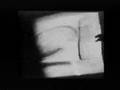 ZEE ARM pixelvision