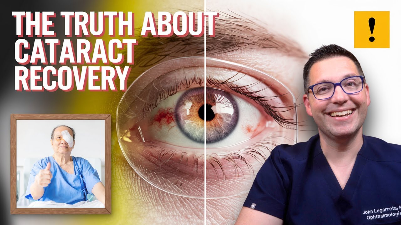 Cataract Surgery Recovery: 5 Surprises You Need To Know!