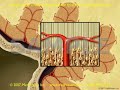  3D 2D medical animation MediVisuals traumatic brain injury TBI trauma axonal axon shear medicine