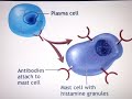 Allergies-Hypersensitivity Type 1