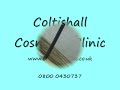 Fractional CO2 laser treatment