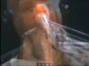 an edit of peter gabriels performance at the k�nixxtreffen (virgin records germany's 20th anniversary) in munich 2002. this was the first time he peformed material from his album up.
part 1 includes excerpts 