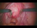 Cirurgia Robotica