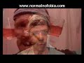 Normalnofobija - Medley 2