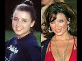 Celebs plastic surgery