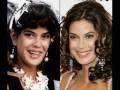 Celebs plastic surgery