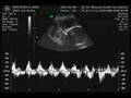 videos de Baby Rickels2