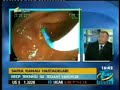 Safra kanal? yaralanmalar?nda ERCP nin yeri nedir? Safra kanal? yaralanmalar?nda ERCP nin yeri nedir?