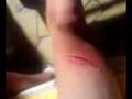 videos de entaille cuisse