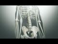 Ankylosing Spondylitis Symptoms