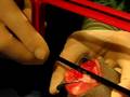 Veterinary Knee Surgery