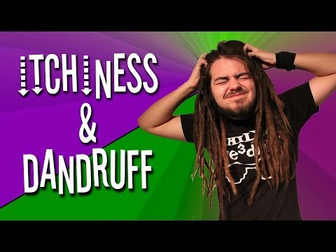 how to relieve dandruff itch